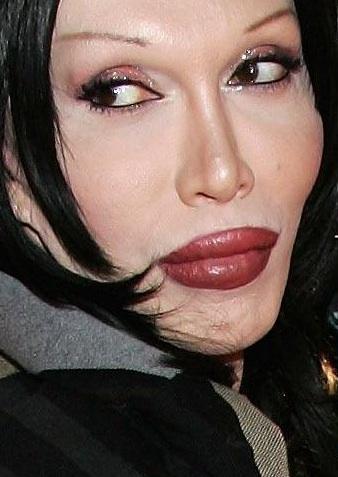 pete burns before and after. pete burns on gay marraige
